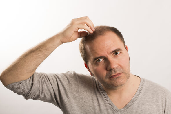 Alopecie a jak ji co nejlépe zvládnout ku prospěchu vlasové pokrývky hlavy